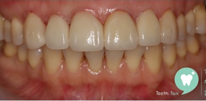 Prosthodontic Treatment